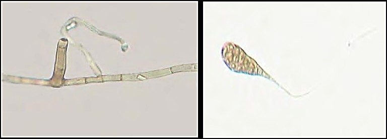 Conidióforos (x 750) y conidio de Alternaria cucumerina (x 750)